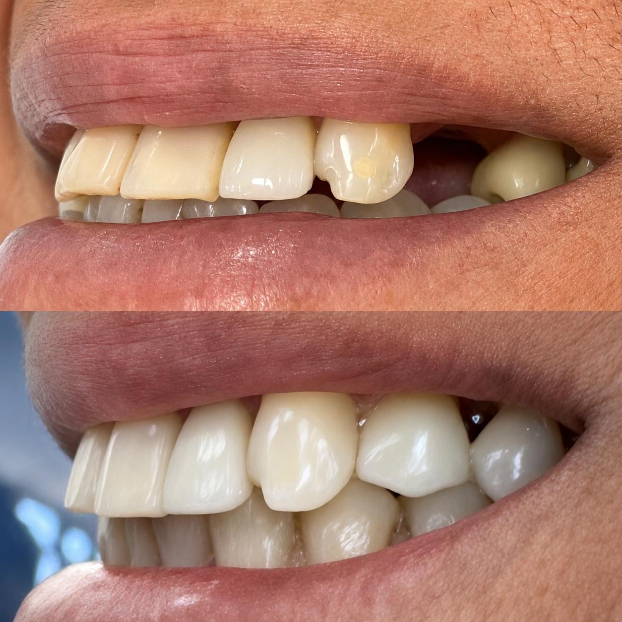 Antes e depois 3