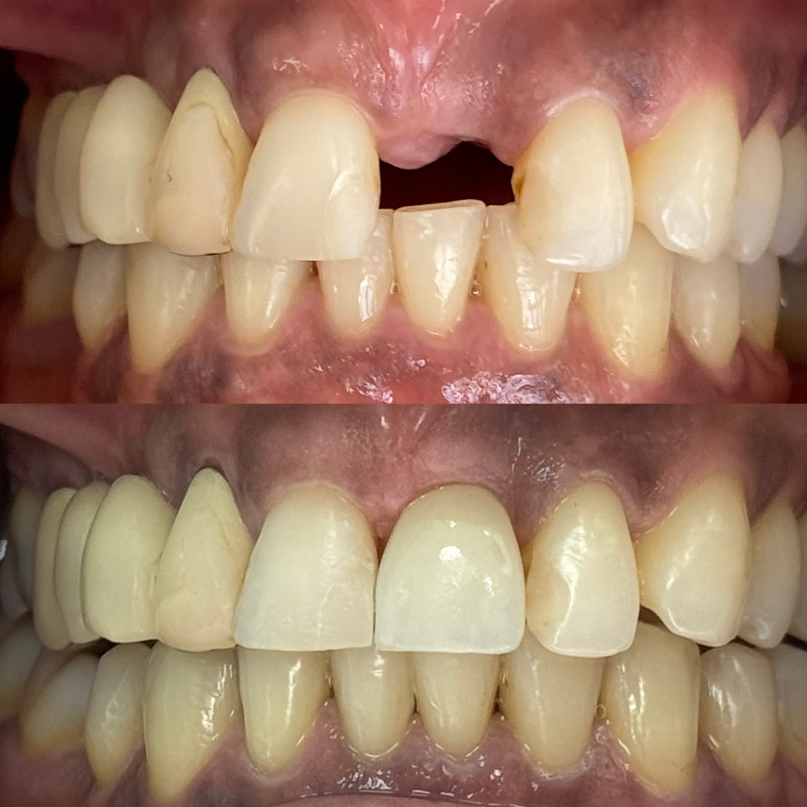 Antes e depois 1