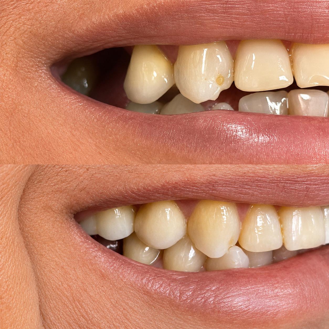 Antes e depois 2
